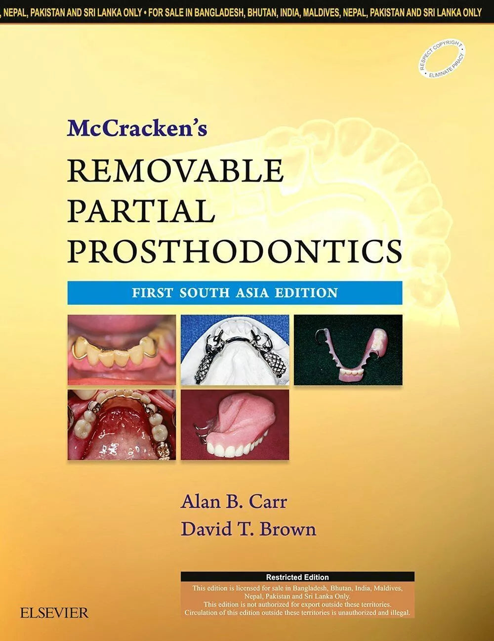 McCracken's Removable Partial Prosthodontics 13th Edition